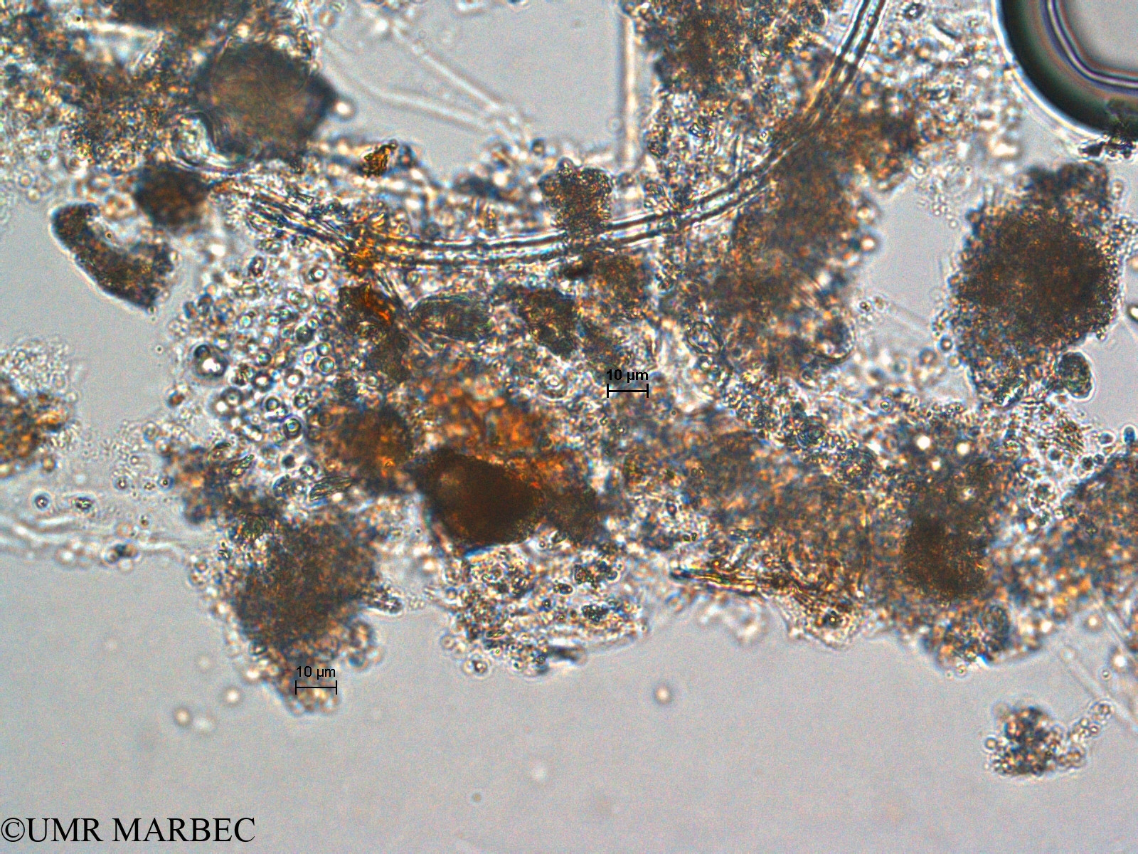 phyto/Scattered_Islands/europa/COMMA April 2011/Aphanocapsa sp4 (ancien Chroococcus sp7)(copy).jpg